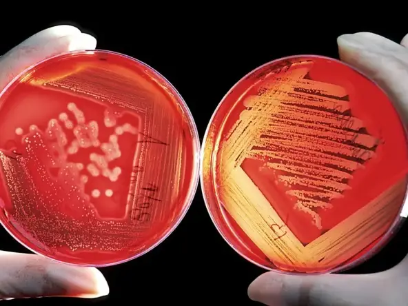 Perawatan GRC Minimalis Agar Tetap Tahan Lama